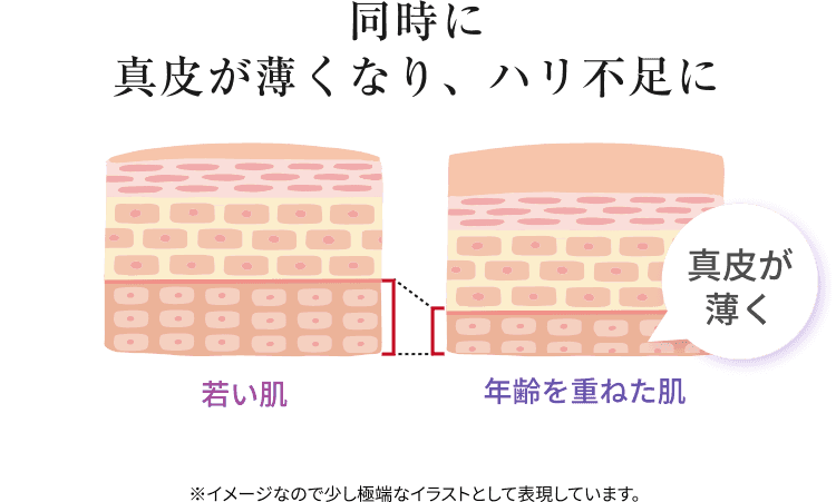 年齢とともに角層は分厚くなり美容成分が浸透しにくくなります。同時に真皮が薄くなり、ハリ不足に※イメージなので少し極端なイラストとして表現しています。