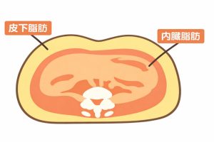 皮下脂肪と内臓脂肪