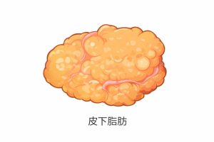 皮下脂肪のイラスト