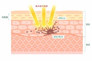 メラノサイト