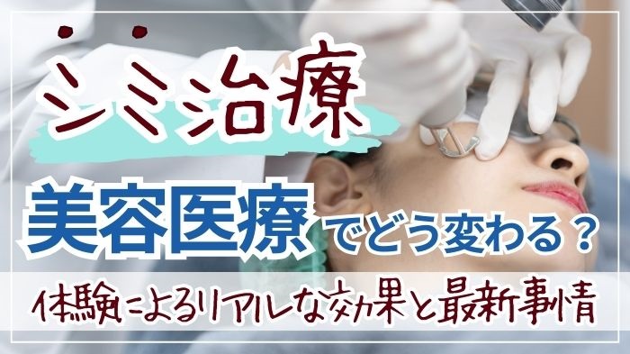 シミ治療は美容医療でどうかわる？体験によるリアルな効果と最新事情