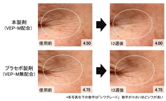 VEP-Mのシワ改善効果の実験