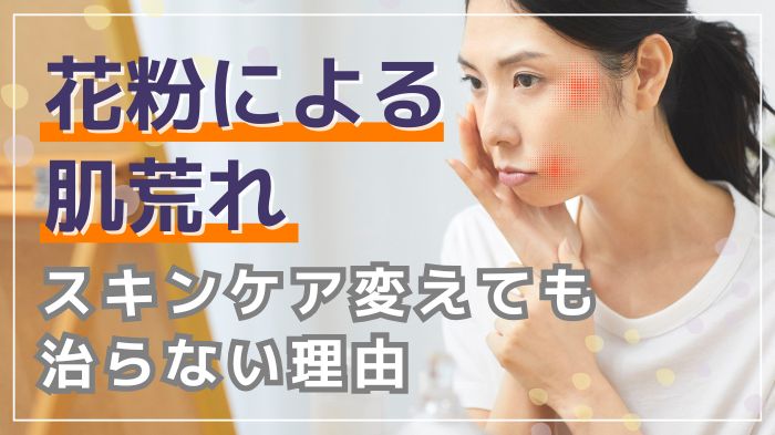 花粉肌荒れがスキンケアしても治らない理由