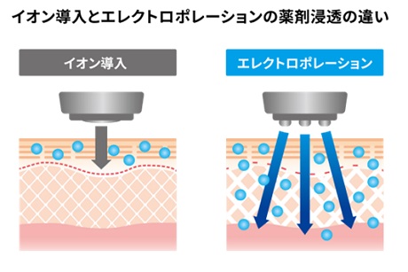  イオン導入とエレクトロポレーションの浸透の違い