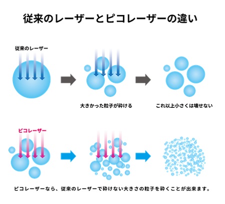 ピコレーザーのメカニズム