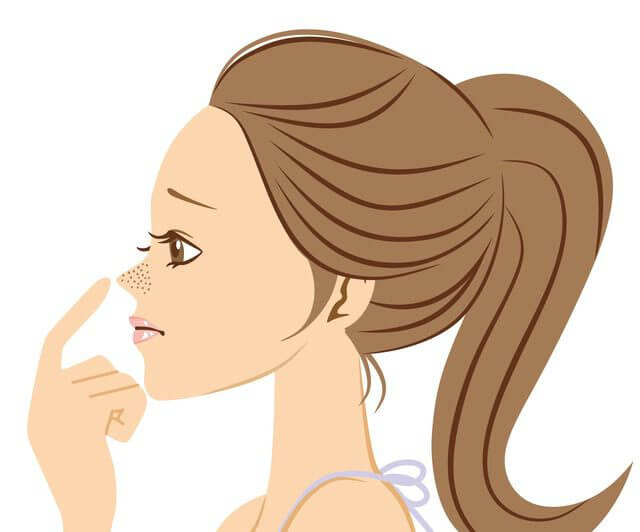 いちご鼻・毛穴の黒ずみのある女性