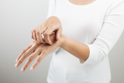 皮脂欠乏性湿疹が気になる女性