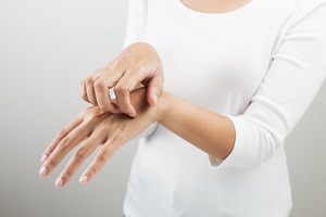 アトピー性皮膚炎の女性