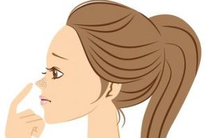 イチゴ鼻に悩む女性