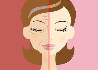 ケミカルピーリング施術前後の顔の比較を表す女性のイラスト