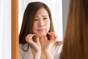 顔のたるみによる二重あごを気にする女性