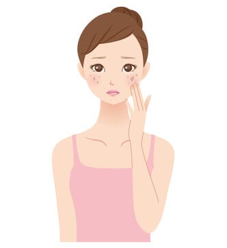 シミを気にする女性