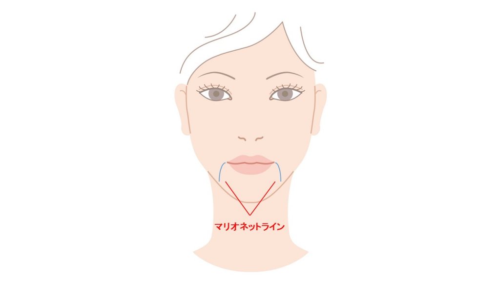 マリオネットラインの目立つ女性