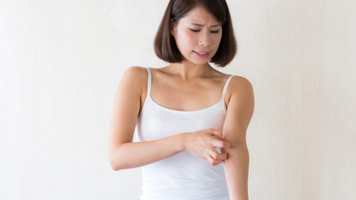 乾燥肌による肌のかゆみを感じる女性
