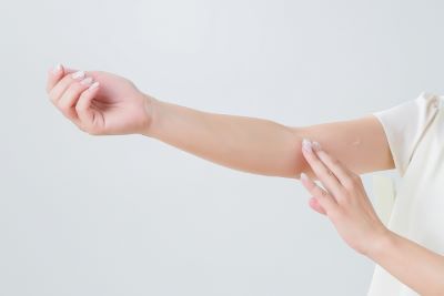 アトピー性皮膚炎で悩む女性の腕