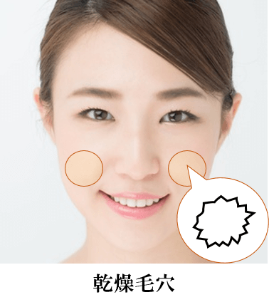 乾燥毛穴が目立ちやすいパーツの写真