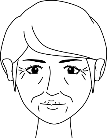 顔中にしわが一杯の状態の女性