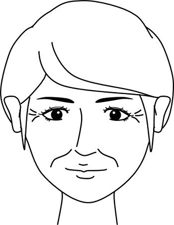 しわが深く刻まれていつでも目立つ状態の女性