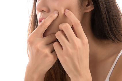ニキビが気になる女性