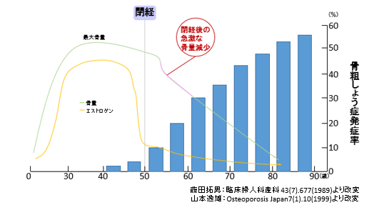 骨量と骨粗鬆症の図