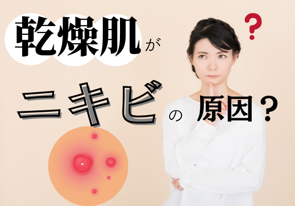 乾燥肌がニキビの原因になるって本当？予防と改善対策