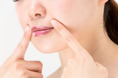 ほうれい線がきになる女性