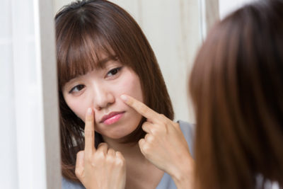 ほうれい線をとても気にする女性