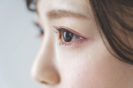 肌のバリア機能低下を気にする女性