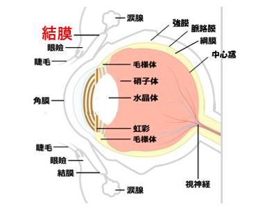 目の構造とアレルギー性結膜炎を起こす結膜の図
