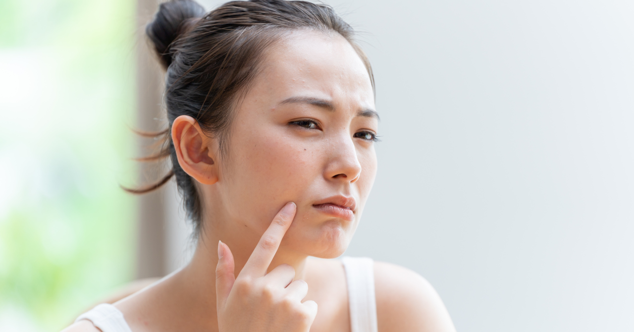 ほうれい線対策の美容液の選び方は、5つの視点で考える！