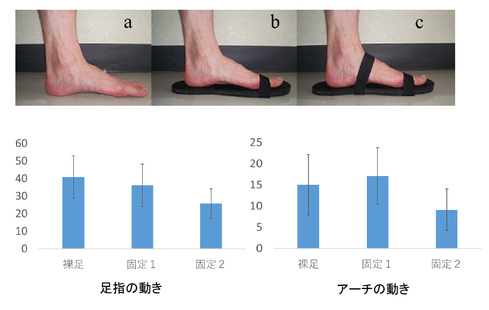 靴を履いている状態はギプス固定と似た状態