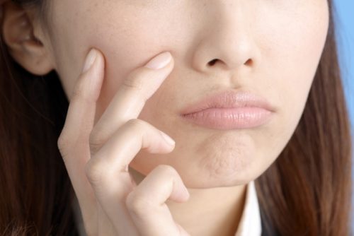 皮脂のケアに悩む女性