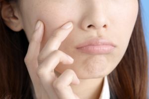 肌のごわつきを気にする女性