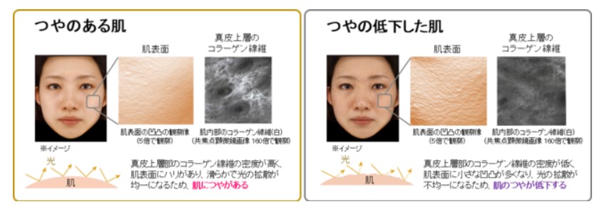 コラーゲン線維の密度によるお肌のツヤの違いの図
