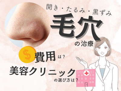 毛穴　治療　美容医療　アイキャッチ