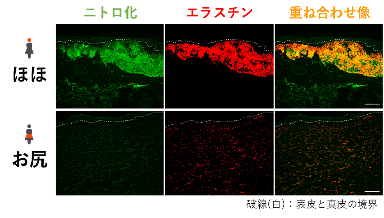 ニトロ化したエラスチンの染色体像