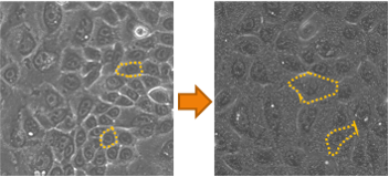 伸縮刺激を受けた培養細胞が拡大