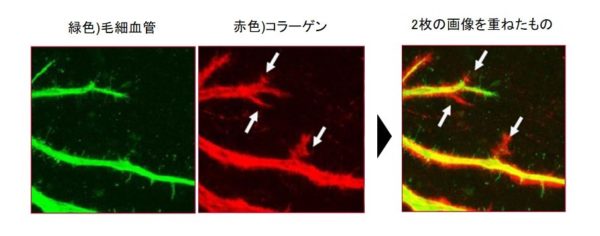毛細血管の周囲に産生されるコラーゲンの図