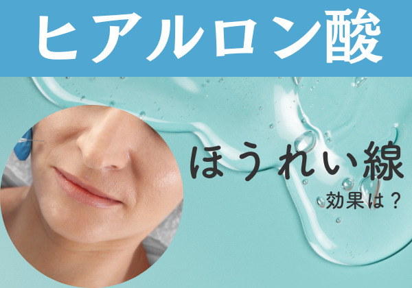 ほうれい線の予防や改善にヒアルロン酸は効果があるの？のアイキャッチ