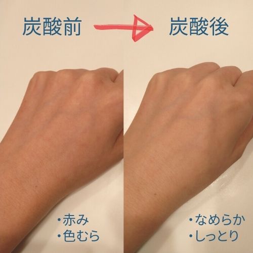 炭酸ミスト使用前・使用後