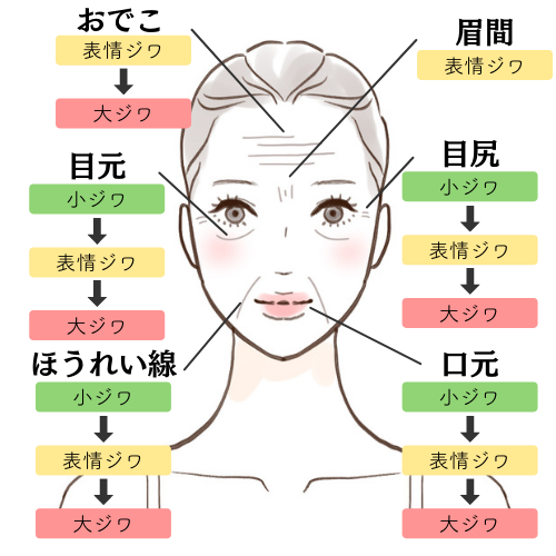顔のしわ