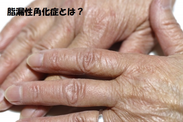 イボのない手の女性