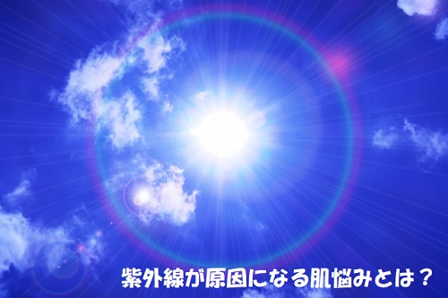 紫外線の原因となる日光