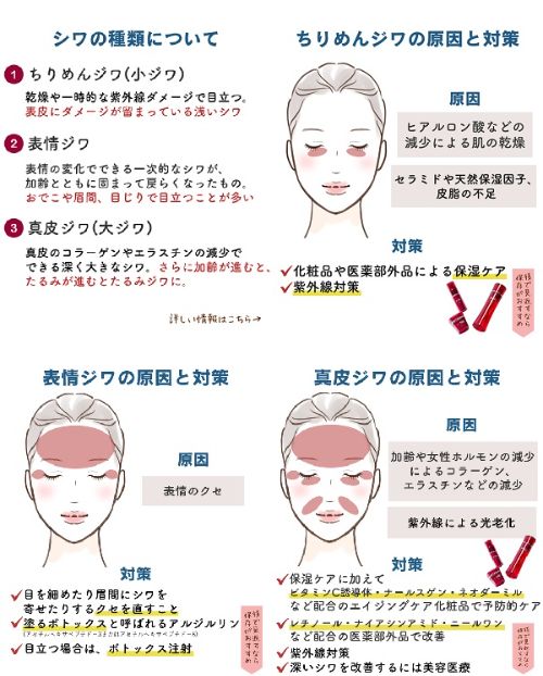 しわの種類を説明する画像
