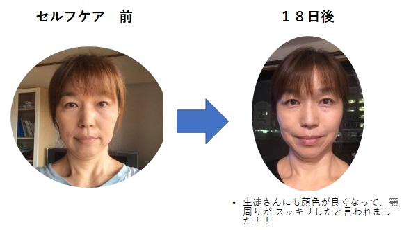 セルフケア実践前と後を比較した写真