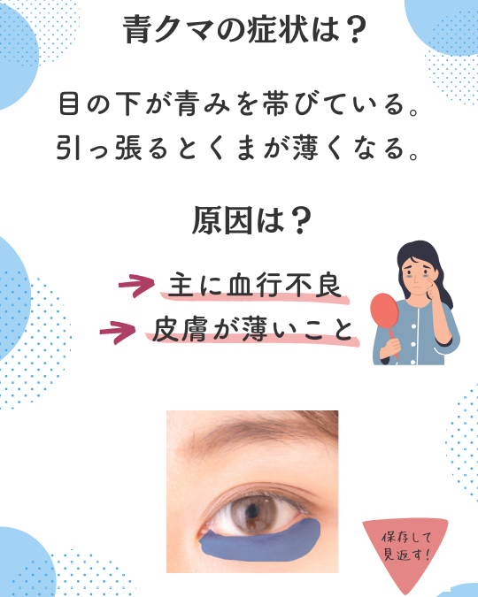 青クマの原因