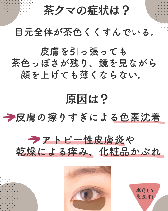 茶クマの原因