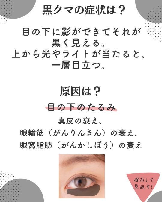 黒クマの原因