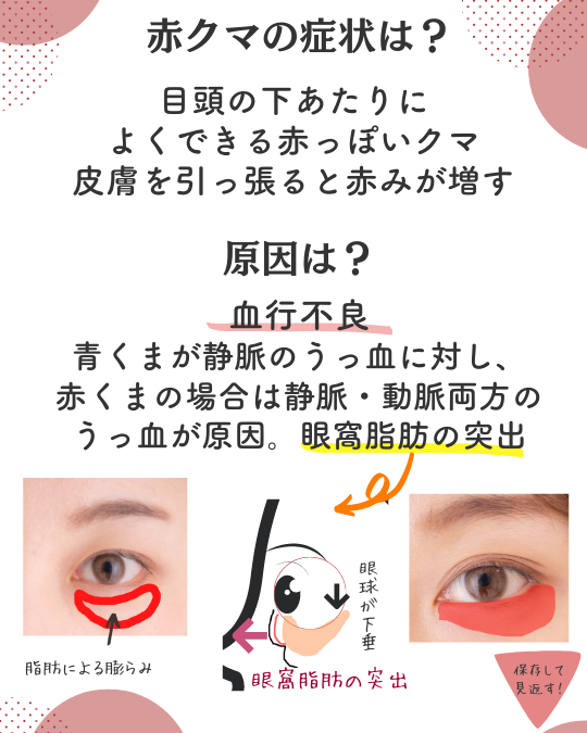 赤クマの原因
