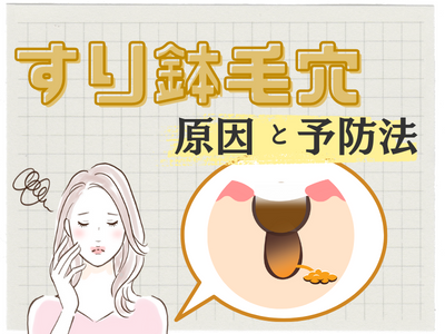 すり鉢毛穴　アイキャッチ